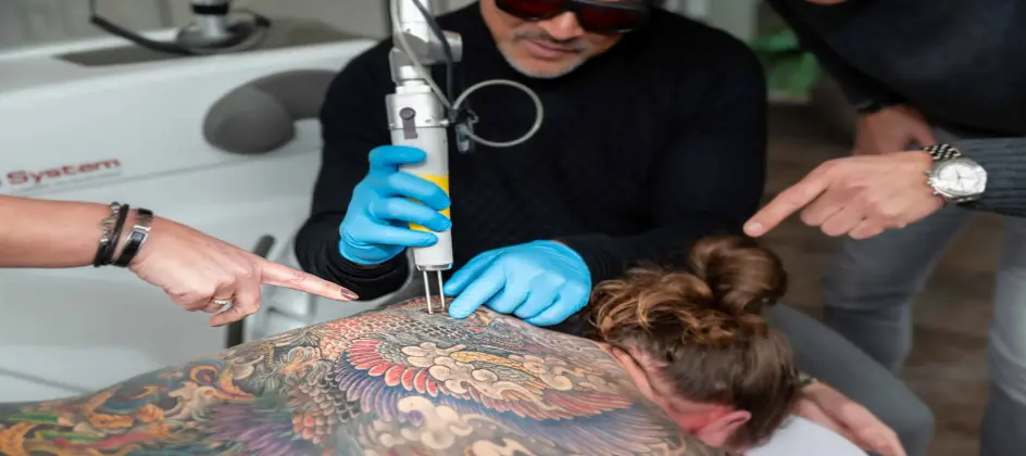 Neuer Berufsverband setzt Standards in boomendem Tattoo-Entfernungsmarkt